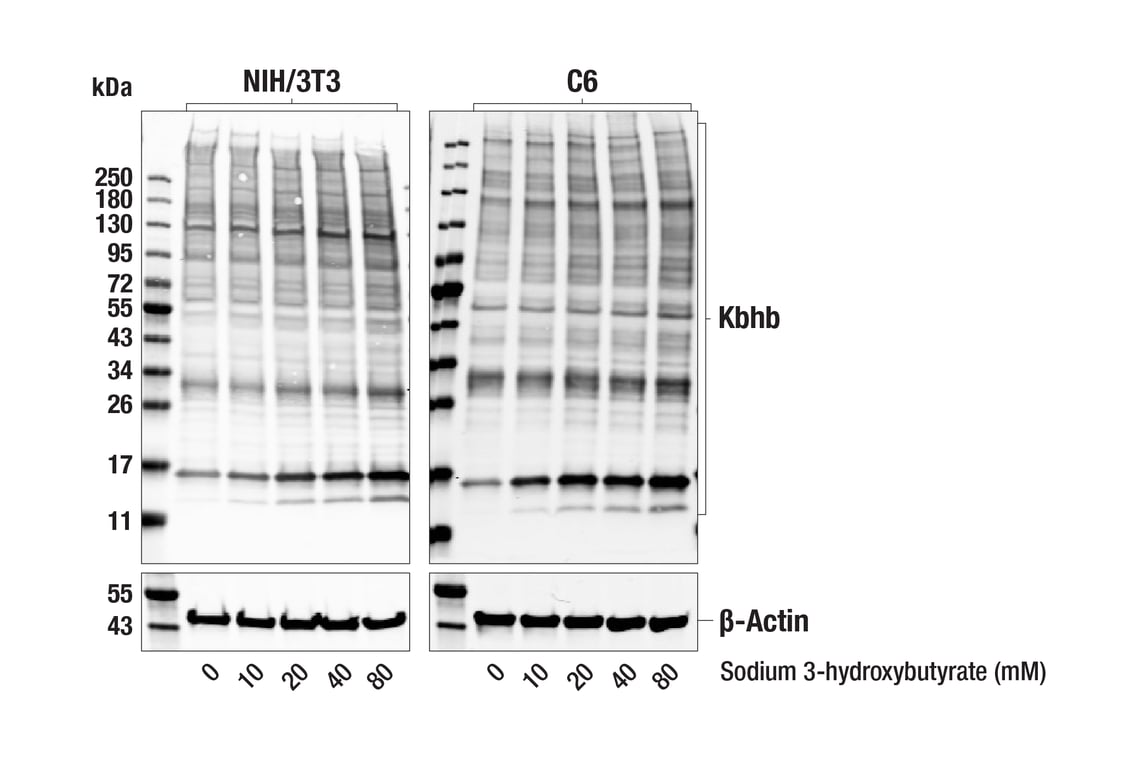 Western Blotting Image 1: β-Hydroxybutyryl Lysine (E6H5Q) Rabbit mAb