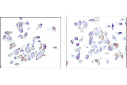 Immunohistochemistry Image 4: Akt (pan) (11E7) Rabbit mAb