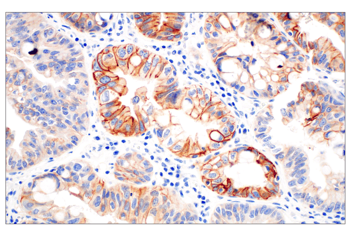 Immunohistochemistry Image 2: Integrin β6 (E4M9P) XP<sup>®</sup> Rabbit mAb