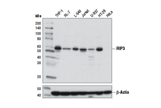 undefined Image 1: PhosphoPlus<sup>®</sup> RIP3 (Ser227) Antibody Duet