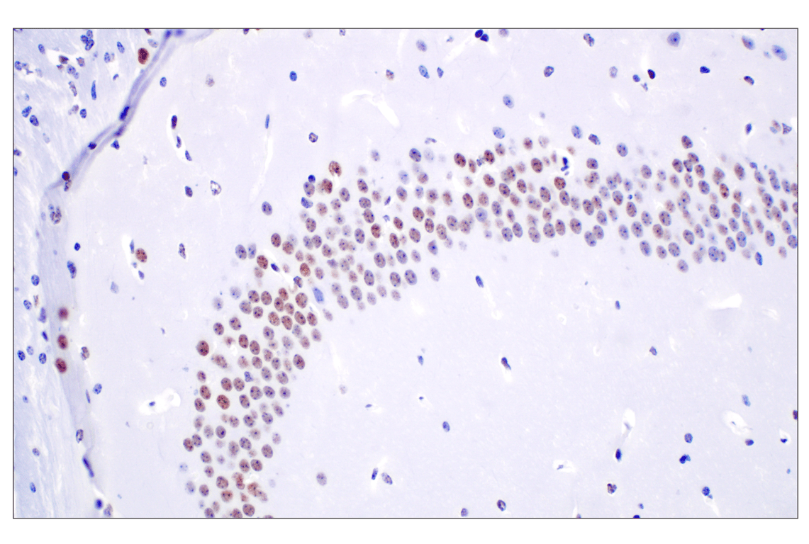 Immunohistochemistry Image 5: TCF4/ITF2 (E3X2Y) Rabbit mAb