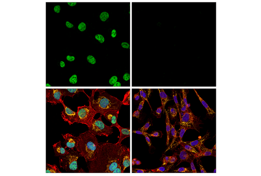 undefined Image 68: Epithelial-Mesenchymal Transition (EMT) IF Antibody Sampler Kit