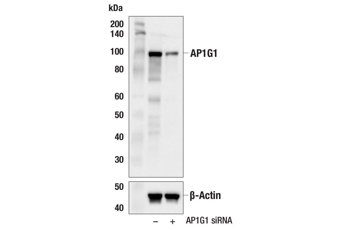 Western Blotting Image 2: AP1G1 (F2S8B) Rabbit mAb