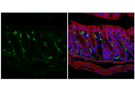 undefined Image 7: Late-Onset Alzheimer's Disease Risk Gene (Mouse Model) Antibody Sampler Kit