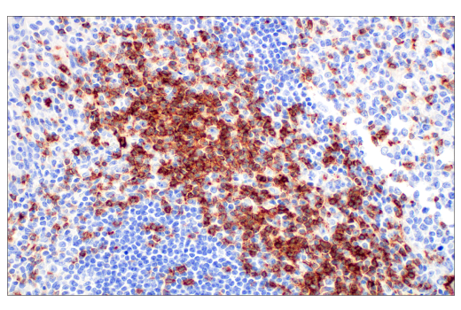 Immunohistochemistry Image 3: CD7 (E4G1Q) XP<sup>®</sup> Rabbit mAb (BSA and Azide Free)