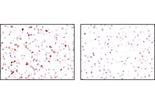 Immunohistochemistry Image 3: Phospho-Met (Tyr1234/1235) (D26) XP<sup>®</sup> Rabbit mAb (BSA and Azide Free)