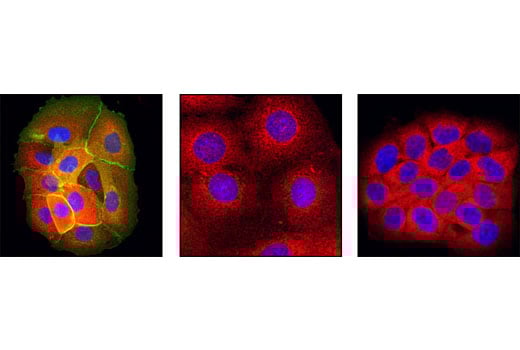 undefined Image 27: Lung Cancer RTK Antibody Sampler Kit
