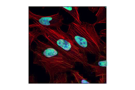undefined Image 24: Non-Homologous End Joining (NHEJ) DNA Repair Antibody Sampler Kit