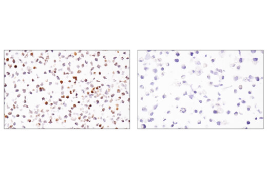 Immunohistochemistry Image 3: BCL6 (E5I8I) Rabbit mAb