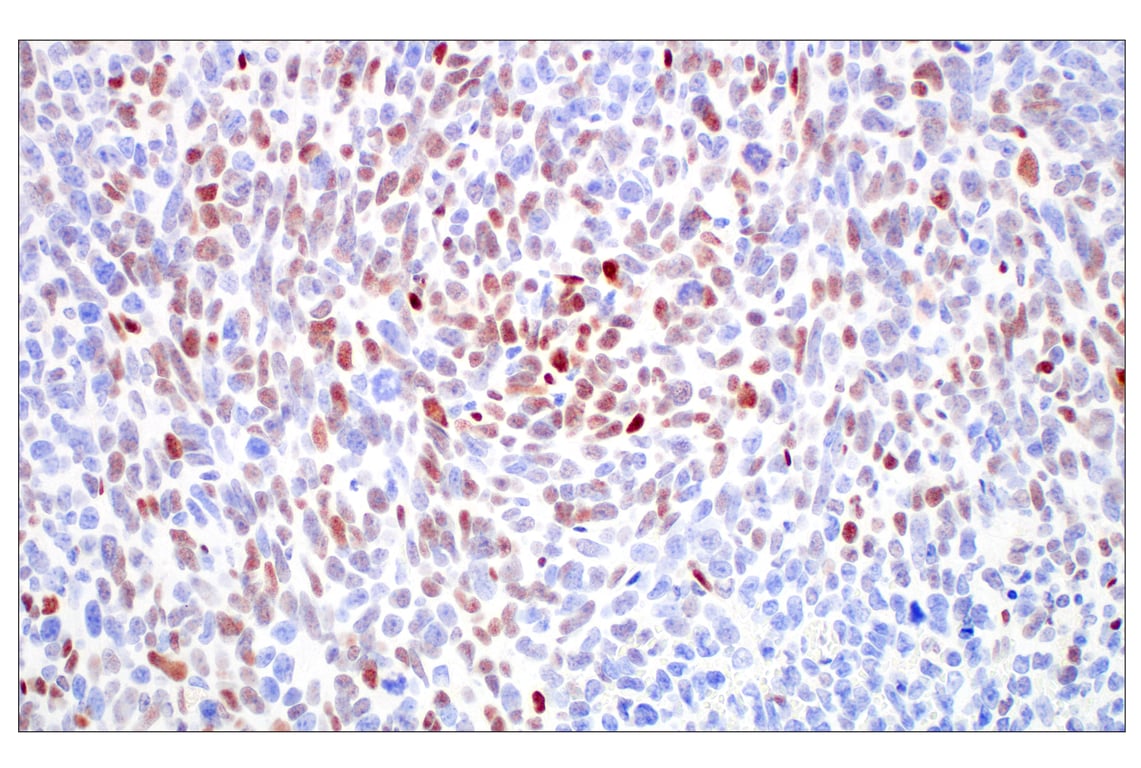 Immunohistochemistry Image 7: c-Fos (E2I7R) XP<sup>®</sup> Rabbit mAb