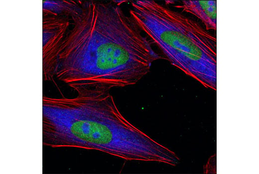 Immunofluorescence Image 1: Ezh2 (D2C9) XP<sup>®</sup> Rabbit mAb (BSA and Azide Free)