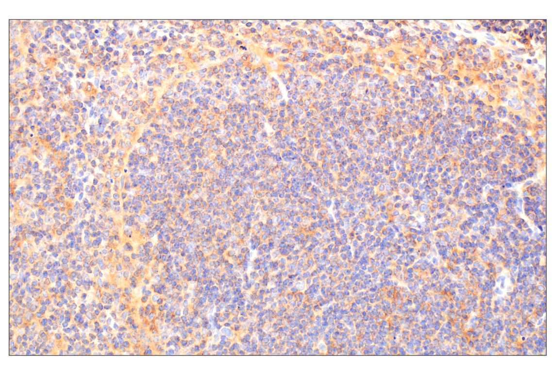 undefined Image 20: Rho-GTPase Antibody Sampler Kit