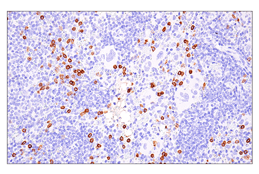 Immunohistochemistry Image 4: NK1.1/CD161 (E6Y9G) Rabbit mAb