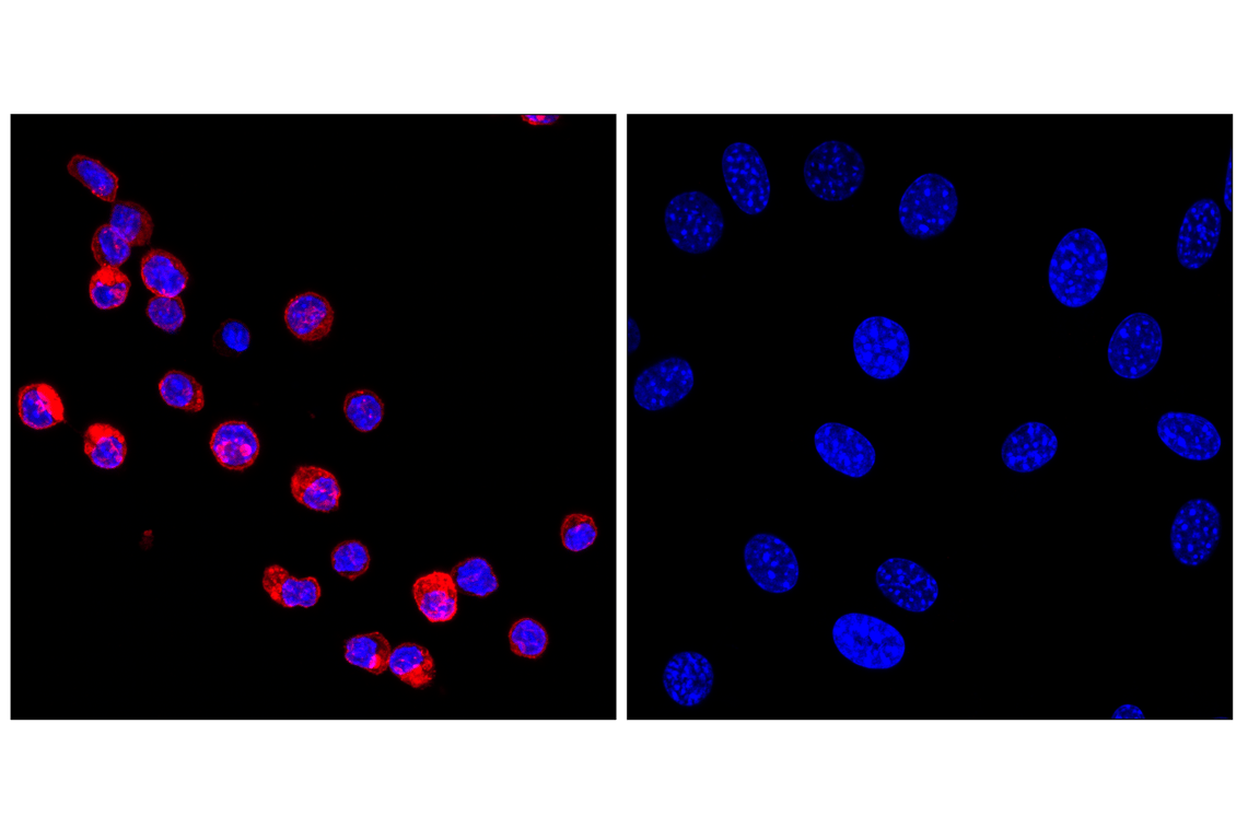 Immunofluorescence Image 1: CD31 (PECAM-1) (F2N3M) Rabbit mAb (Alexa Fluor<sup>®</sup> 555 Conjugate)