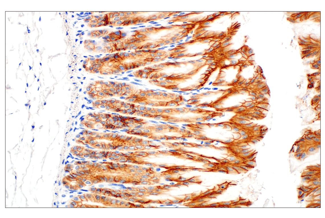 undefined Image 44: Cadherin-Catenin Antibody Sampler Kit