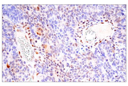 Immunohistochemistry Image 3: Bcl-3 (E4D4K) Rabbit mAb