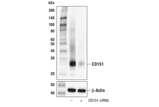 Western Blotting Image 2: CD151 (E4I9J) XP<sup>®</sup> Rabbit mAb