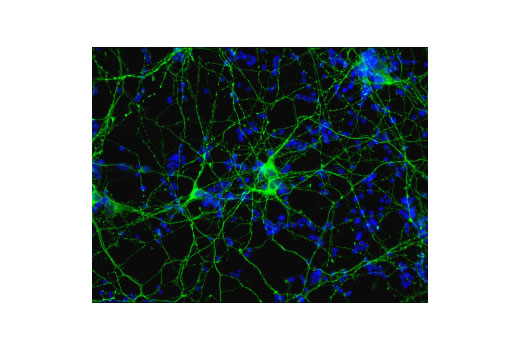 undefined Image 35: LRP1-mediated Endocytosis and Transmission of Tau Antibody Sampler Kit