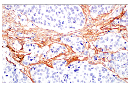 Immunohistochemistry Image 6: COL3A1 (E8D7R) XP<sup>®</sup> Rabbit mAb (BSA and Azide Free)