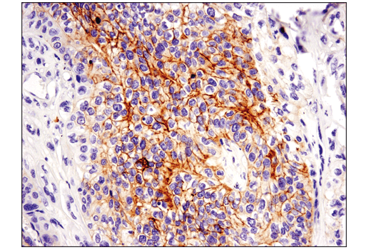 Immunohistochemistry Image 1: c-Kit (D3W6Y) XP<sup>®</sup> Rabbit mAb (BSA and Azide Free)