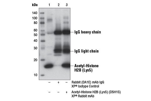 Immunoprecipitation Image 1: Acetyl-Histone H2B (Lys5) (D5H1S) XP<sup>®</sup> Rabbit mAb