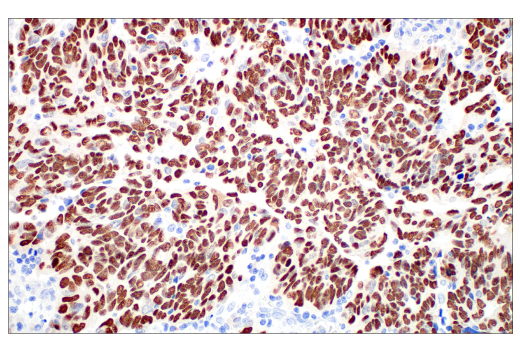 Immunohistochemistry Image 1: MAGE-C2/CT10 (E7B8D) XP<sup>®</sup> Rabbit mAb