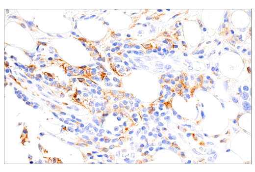 Immunohistochemistry Image 1: GM-CSF Receptor α (E8Z3S) Rabbit mAb