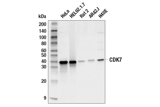 Western Blotting Image 1: CDK7 (MO1) Mouse mAb