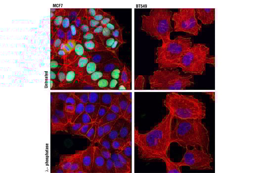 Immunofluorescence Image 1: Phospho-Rb (Ser807/811) (D20B12) XP<sup>®</sup> Rabbit mAb