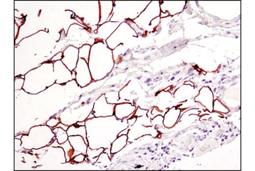 Immunohistochemistry Image 1: Perilipin-1 (D1D8) XP<sup>®</sup> Rabbit mAb