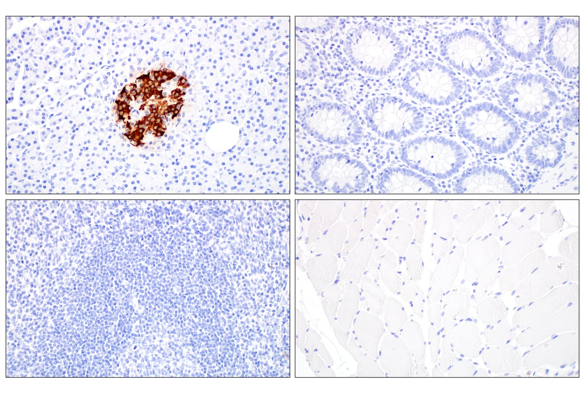 Immunohistochemistry Image 2: C-Peptide (E7U7F) XP<sup>®</sup> Rabbit mAb