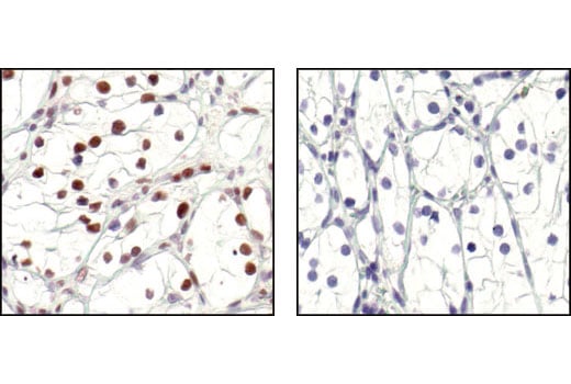 undefined Image 13: PhosphoPlus<sup>®</sup> CREB (Ser133) Antibody Duet