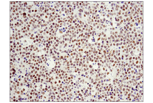 Immunohistochemistry Image 2: LRF/Pokemon (D7U2O) Rabbit mAb