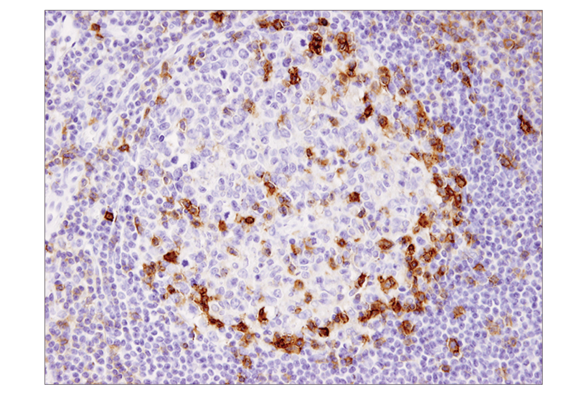 Immunohistochemistry Image 4: ICOS (D1K2T<sup>™</sup>) Rabbit mAb (BSA and Azide Free)