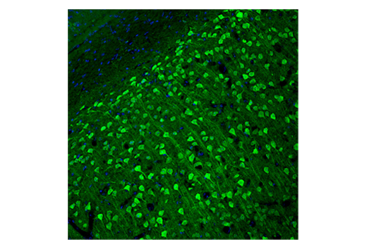 Immunofluorescence Image 2: UCHL1 (D3T2E) XP<sup>®</sup> Rabbit mAb