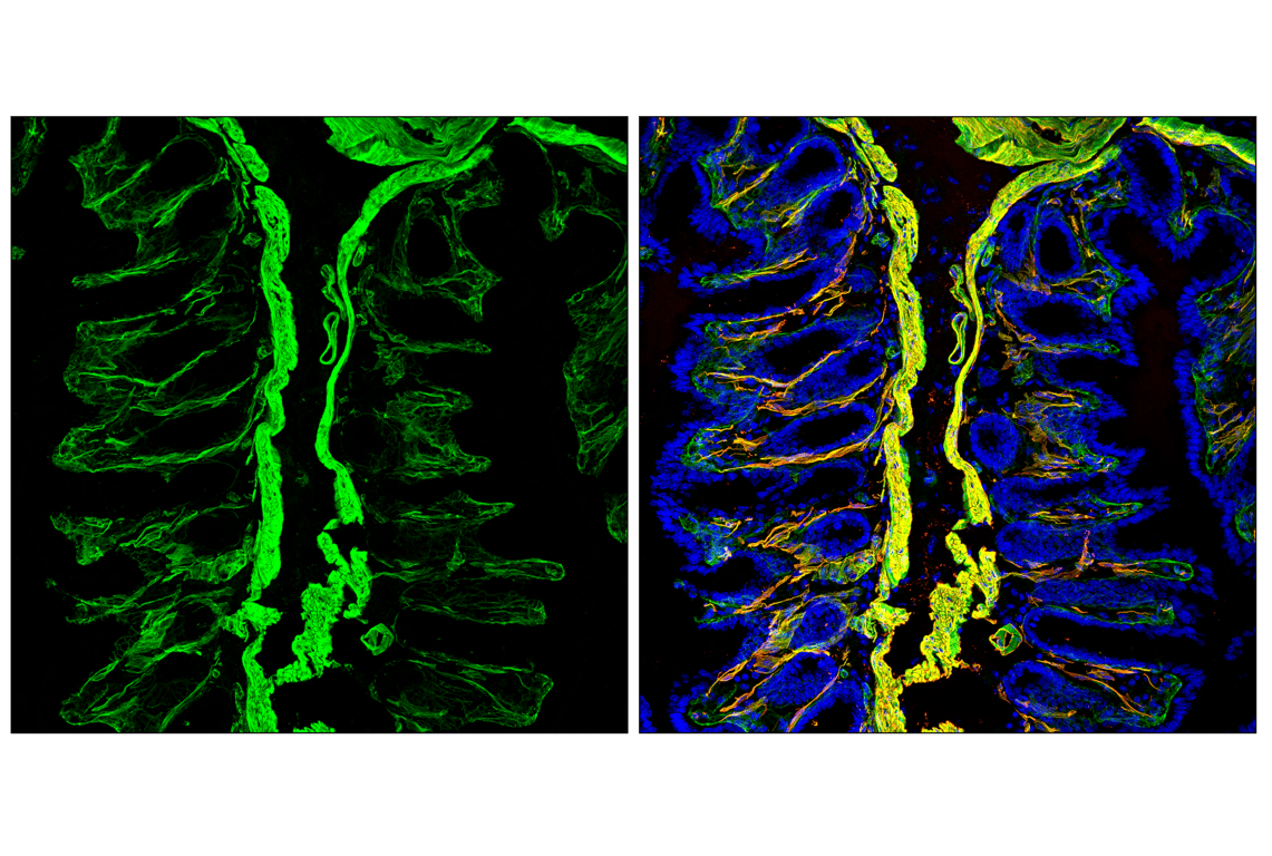 Immunofluorescence Image 4: Caldesmon-1 (D5C8D) XP<sup>®</sup> Rabbit mAb