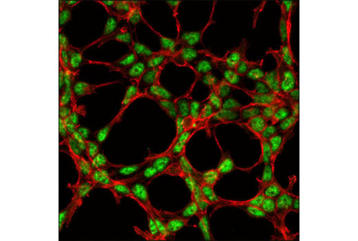 Immunofluorescence Image 1: SKAR α/β (D65E8) XP<sup>®</sup> Rabbit mAb