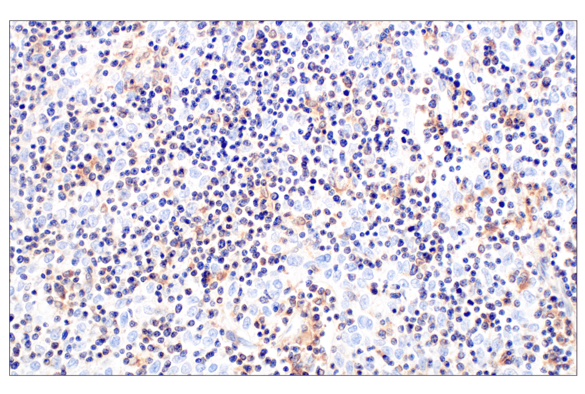 undefined Image 14: Rho-GTPase Antibody Sampler Kit