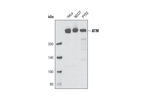 undefined Image 3: PhosphoPlus<sup>®</sup> ATM (Ser1981) Antibody Duet