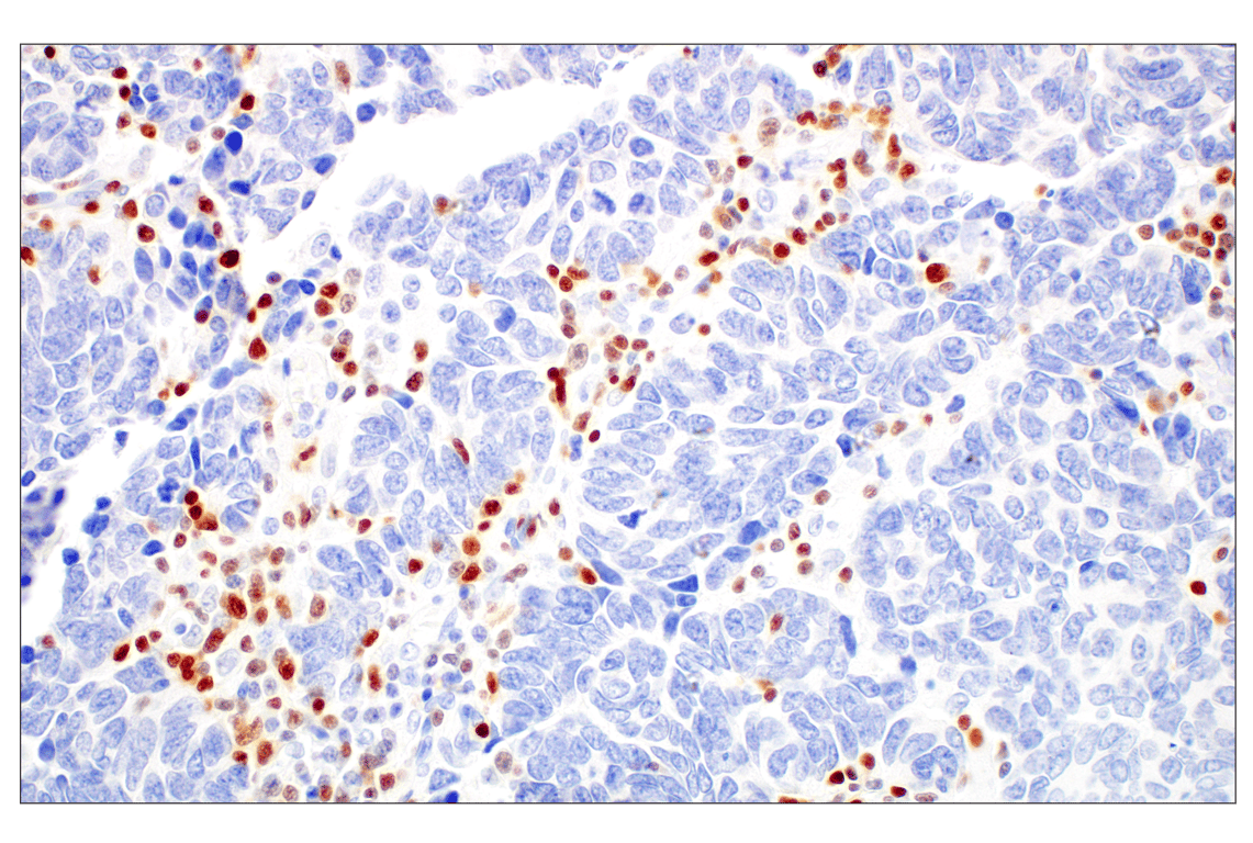 Immunohistochemistry Image 4: T-bet/TBX21 (E4I2K) Rabbit mAb