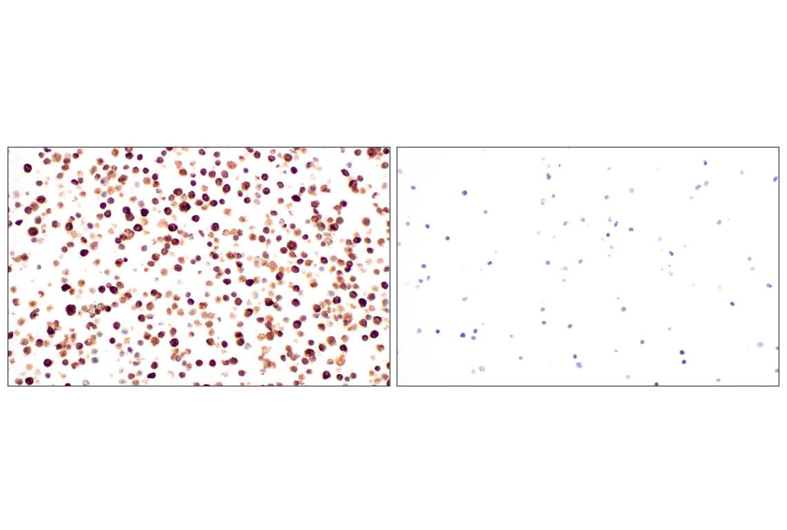 Immunohistochemistry Image 11: Neutrophil Elastase (F4H3X) Rabbit mAb (BSA and Azide Free)