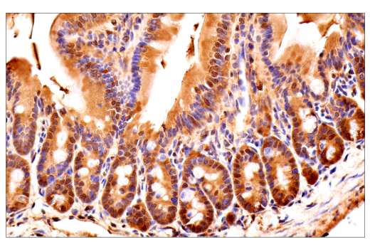 Immunohistochemistry Image 12: Ubiquitin (E6K4Y) XP<sup>®</sup> Rabbit mAb