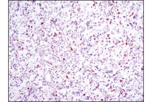 Immunohistochemistry Image 2: Skp2 (D3G5) XP<sup>®</sup> Rabbit mAb