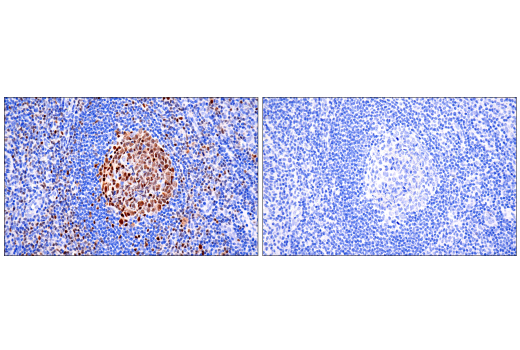undefined Image 89: Human Exhausted CD8<sup>+</sup> T Cell IHC Antibody Sampler Kit