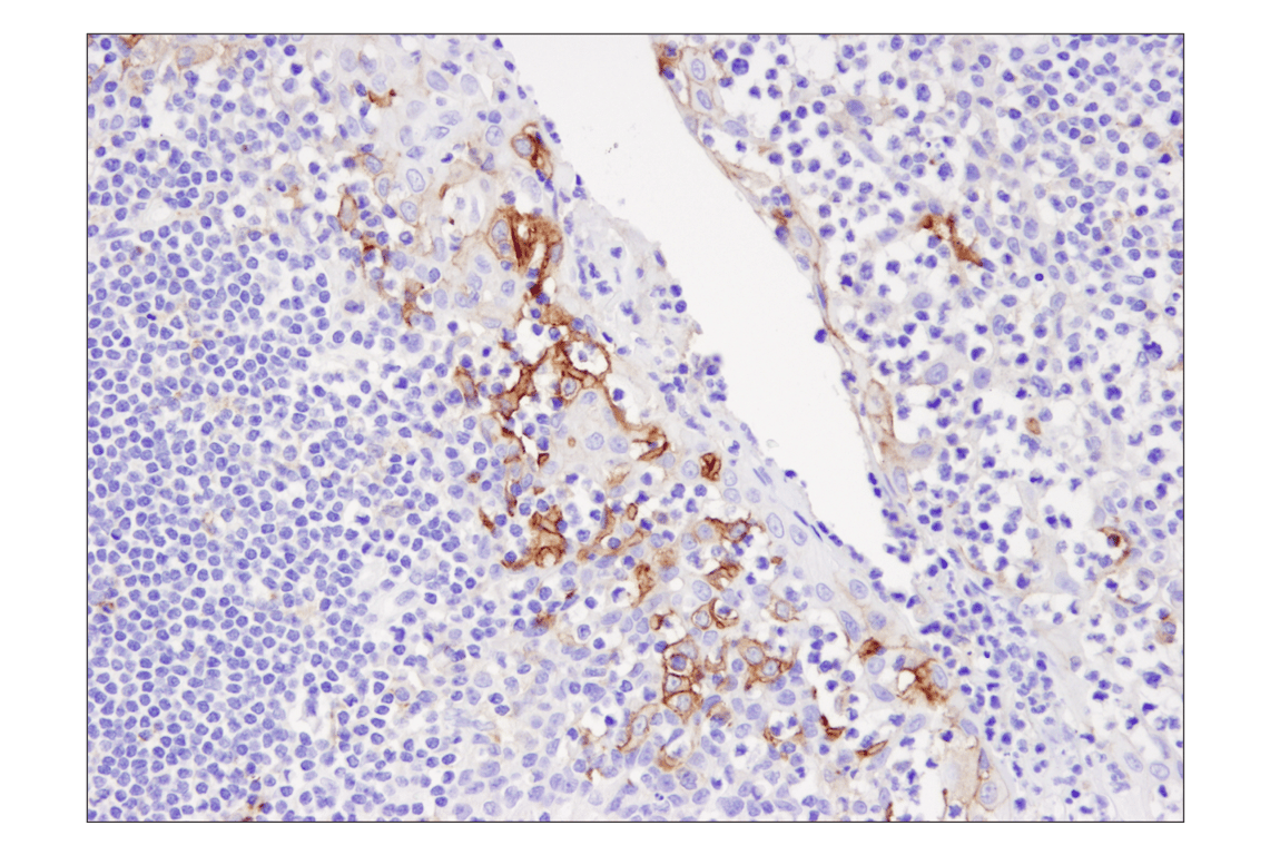 Immunohistochemistry Image 2: PD-L1 (405.9A11) Mouse mAb (BSA and Azide Free)