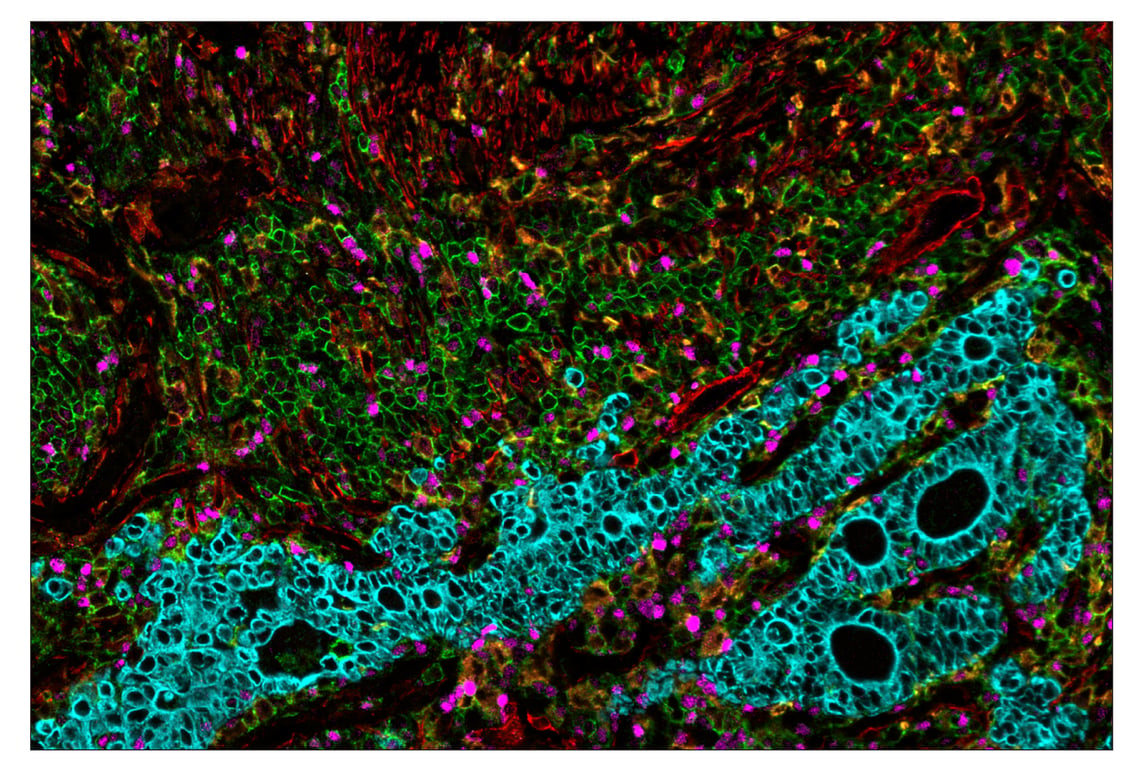 Immunohistochemistry Image 7: CD44 (E7K2Y) & CO-0030-647 SignalStar<sup>™</sup> Oligo-Antibody Pair