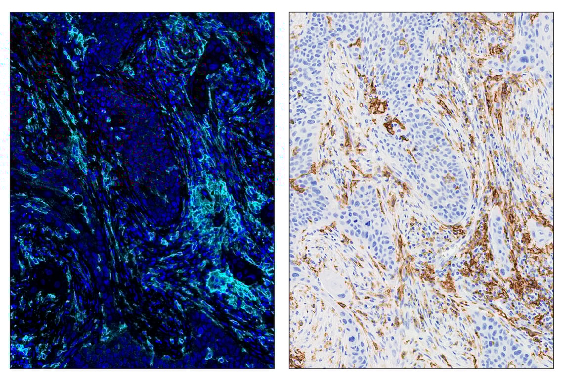 Immunohistochemistry Image 6: CD11c (D3V1E) & CO-0017-647 SignalStar<sup>™</sup> Oligo-Antibody Pair