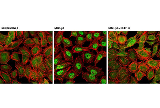 Immunofluorescence Image 1: SMAD2/3 (D7G7) XP<sup>®</sup> Rabbit mAb (BSA and Azide Free)