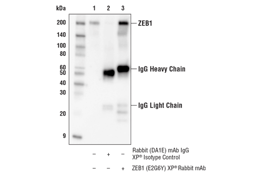 undefined Image 45: Epithelial-Mesenchymal Transition (EMT) IF Antibody Sampler Kit