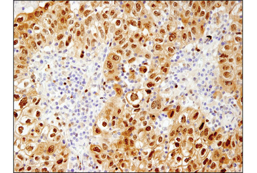 Immunohistochemistry Image 1: HSP70 (D1M6J) Mouse mAb